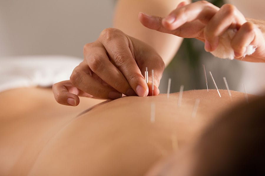 Acupuncture Clinique Sport Santé Laurentides